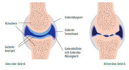 Arthrose Kniegelenk Pferd